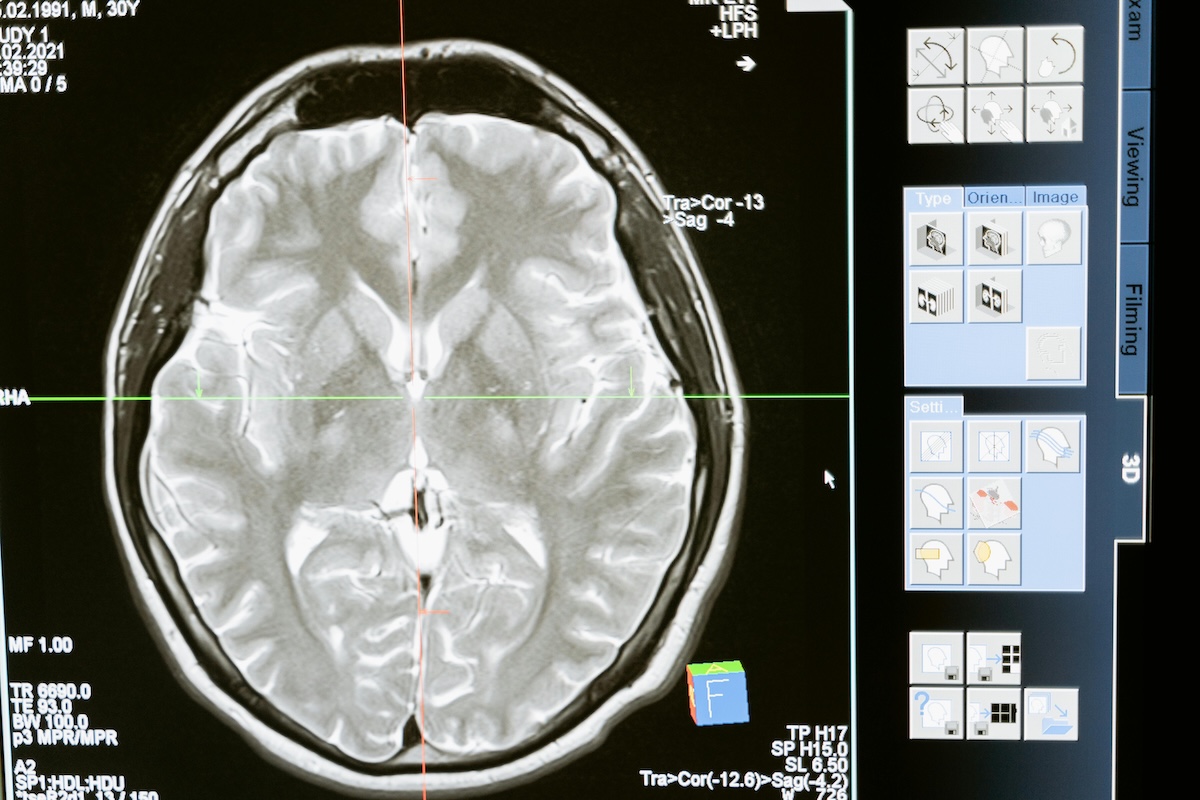journaling impacts the brain positively